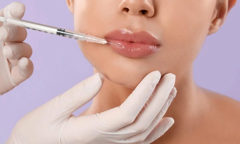 Services lips, lip filler, filler, botox, facial treatment, injection, beauty, botox, botox, botox, botox, botox