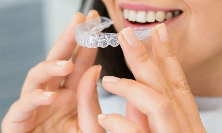 pexels photo 11887613 11887613 Close-up of a woman holding a clear dental aligner, showcasing dental health and a bright smile.