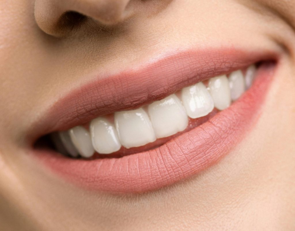 pexels photo 3762441 3762441 A close-up image focusing on a woman's smiling mouth, showing white teeth and pink lips.